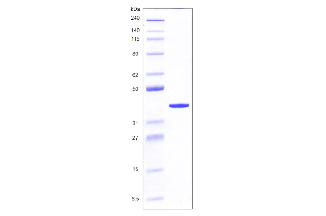 [MC03-100] Recombinant Human Galectin 8, variant 1, His Tag (317 a.a.) -100 ug